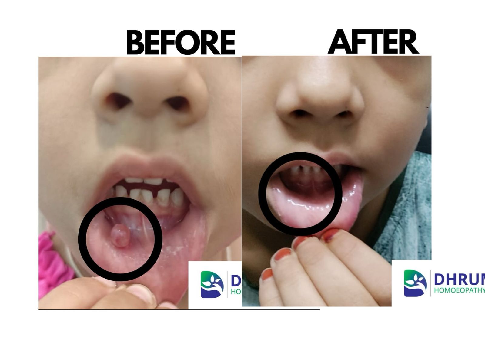 Skin Disorders